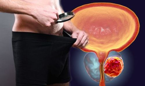 EvoProst